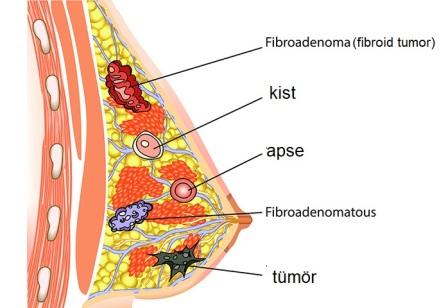 Awareness and Molecular Details in the Diagnosis and Treatment of Breast Cancer
